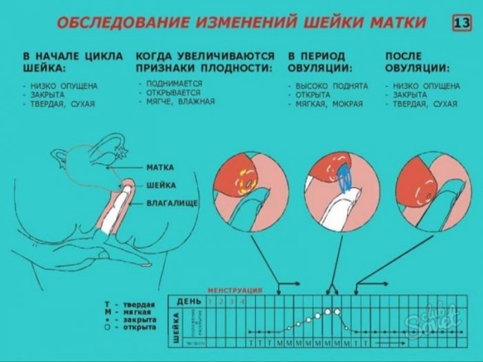 Ідеальна шийка матки: якою вона має бути? Ідеальна шийка матки: якою вона має бути?
