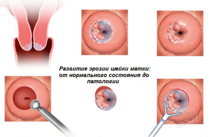 Как выглядит шейка матки