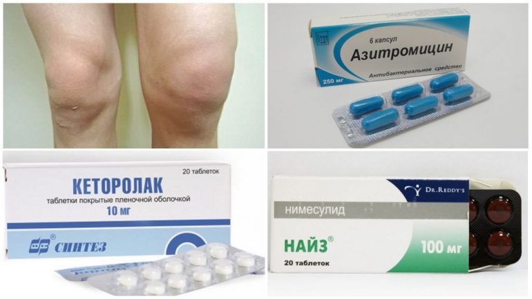 Методи лікування Методи лікування