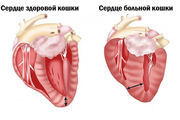 Гіпертрофічна кардіоміопатія у кішок (ГКМП) Гіпертрофічна кардіоміопатія у кішок (ГКМП)