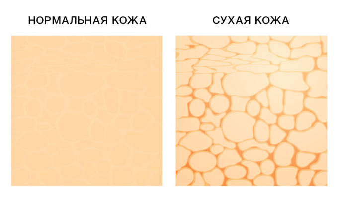 Правила догляду за сухою шкірою обличчя