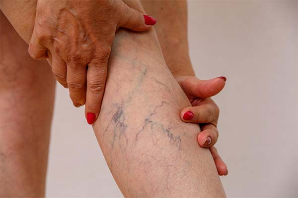 До чого сняться вени на руках чи ногах — 33 тлумачення з різних сонників